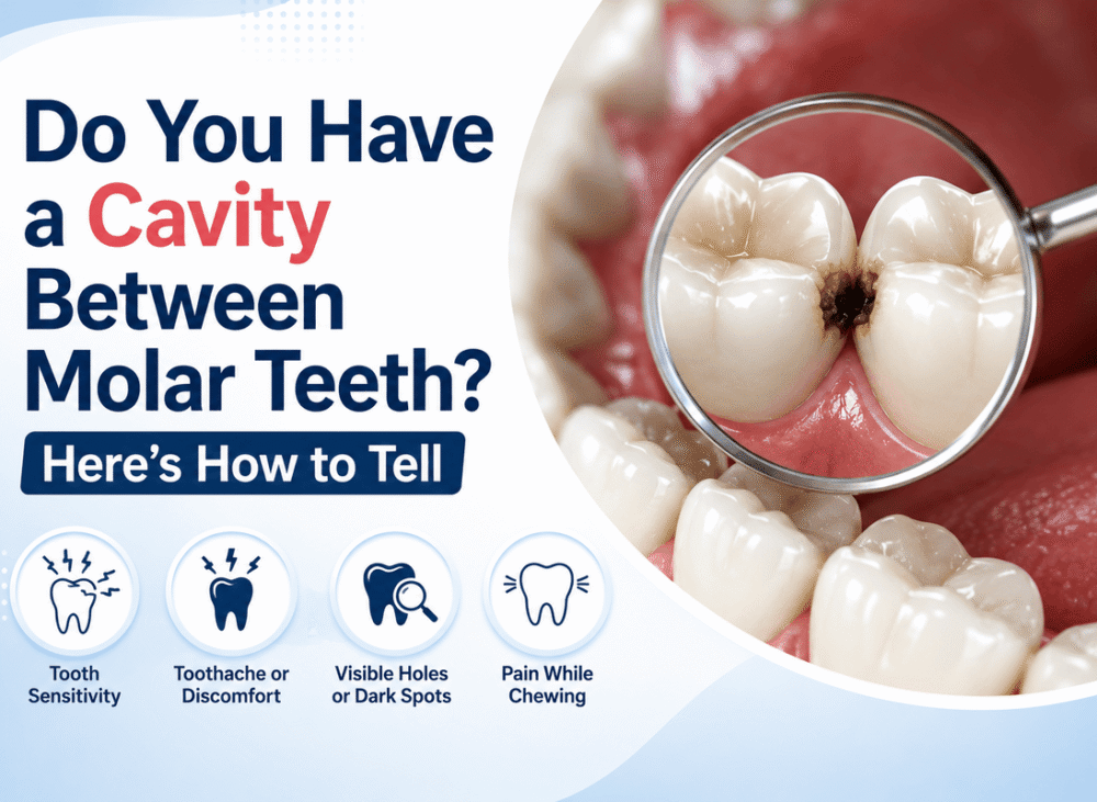 Do You Have a Cavity Between Molar Teeth